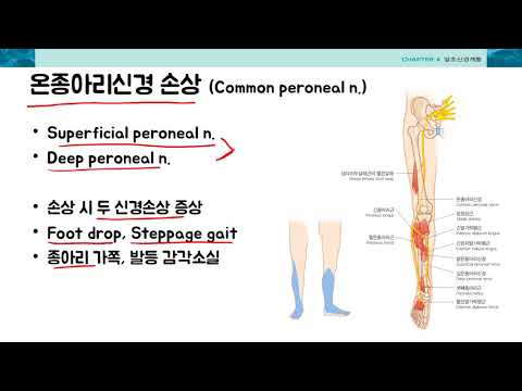 신경해부학 2-3 신경병증2-다리 by learning mate