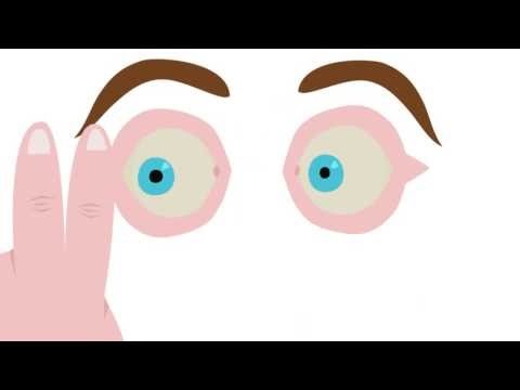 Hoe werkt EMDR? Een animatie.