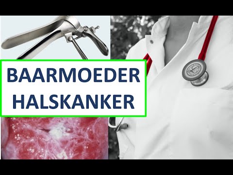 Wat is baarmoederhalskanker? | Symptomen | Oorzaken | Hoe te voorkomen | Wat te doen?