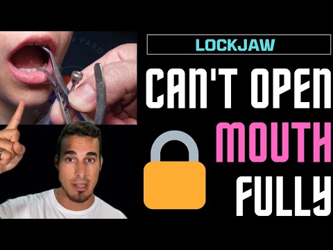 LOCKJAW or TRISMUS - Can’t you open your mouth?