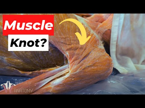 What EXACTLY Are Muscle Knots? And Why Do They Happen?