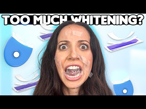 How Often Can I Whiten My Teeth?