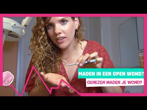 MADEN IN EEN OPEN WOND - TOPDOKS EXTRA