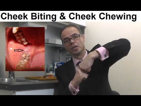 Problems Associated With Cheek Biting/ Cheek Chewing or Morsicatio Buccarum by Dr Mike Mew