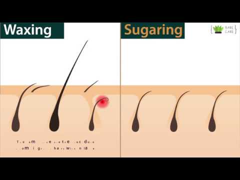 Waxing or Sugar Waxing, which one is better