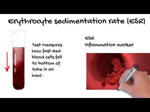 Erythrocyte Sedimentation Rate  (ESR)-  what does the ESR  tell you? Simply Explained.